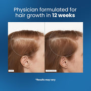 Rosemary Hair Growth Serum Roll On – DHT-Blocking Scalp Treatment with Redensyl & Anagain