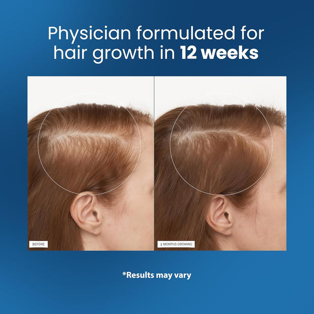 Rosemary Hair Growth Serum Roll On – DHT-Blocking Scalp Treatment with Redensyl & Anagain